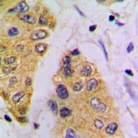 FBP1 Antibody