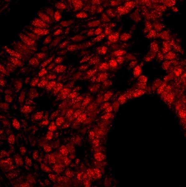 Trimethylguanosine Synthase 1 Antibody (aa150-200)