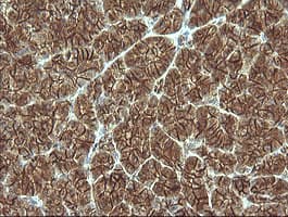 CTNNB1 / Beta Catenin Antibody (clone OTI9C1, Carrier-free)