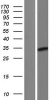 CITED2 Protein (Over-Expression Lysate Myc-DDK (Flag))