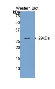 GUSB / Beta Glucuronidase Antibody (aa440-648, FITC)