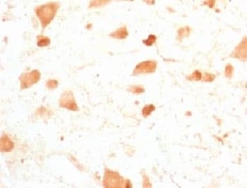 UCHL1 / PGP9.5 Antibody (clone UBCE-L1)