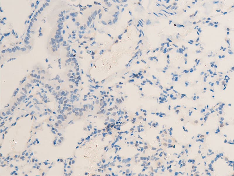 Polyclonal Rabbit anti-Human MITF Antibody (phospho-Ser180,phospho-Ser73, IHC, IF, WB)