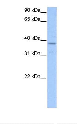 HnRNP-E1 / PCBP1 Antibody (aa208-257)