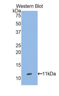 SEPW1 / Selenoprotein W Antibody (aa1-87)