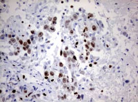 Monoclonal Mouse anti-Human MKI67 / Ki67 Antibody (clone OTI14G1, aa1160-1493, IHC)