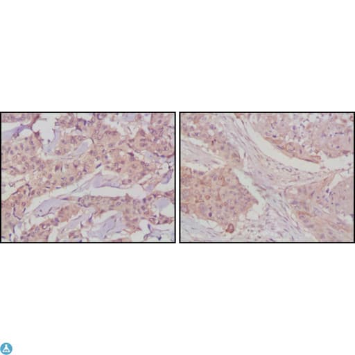 Monoclonal Mouse anti-Human GSK3B / GSK3 Beta Antibody (IHC, IF, WB)