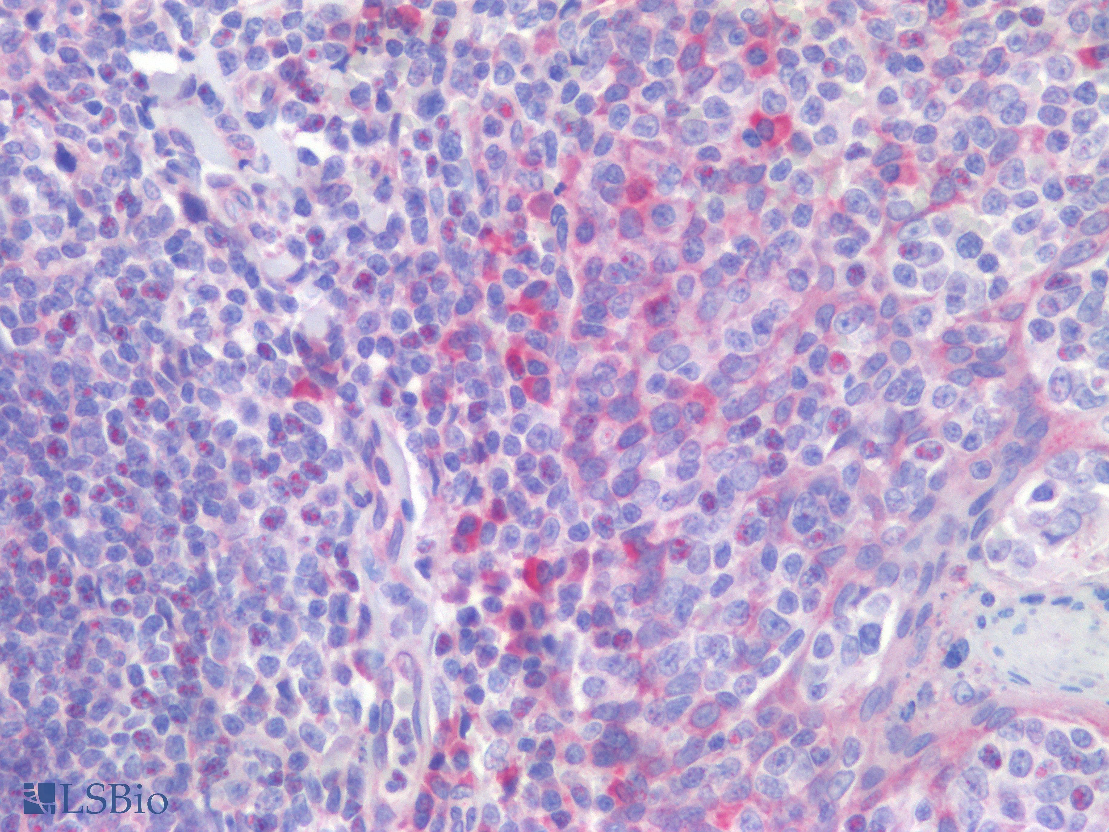 PathPlus™ IL23R Antibody