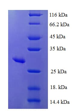 Human MSRA Protein (Recombinant His)
