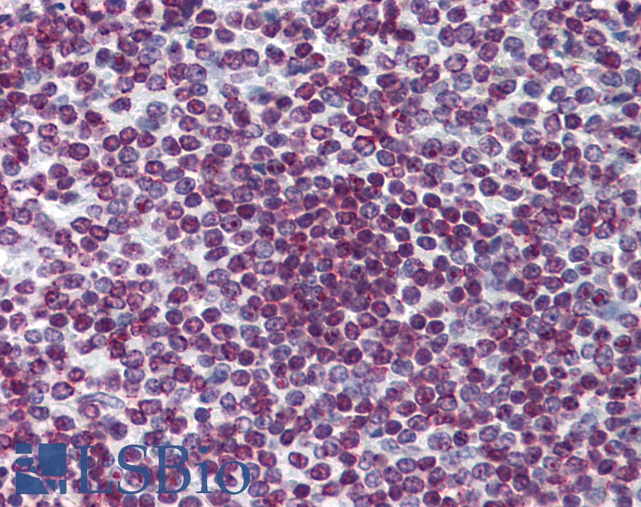 IHC-plus™ FOXO3 / FOXO3A Antibody (clone 4F2)