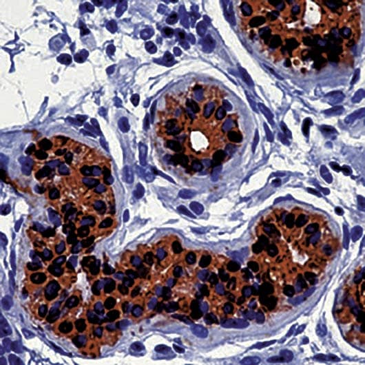 Monoclonal Mouse anti-Human KRT19 / CK19 / Cytokeratin 19 Antibody (clone A53-B/A2.26, aa312-335, IHC)