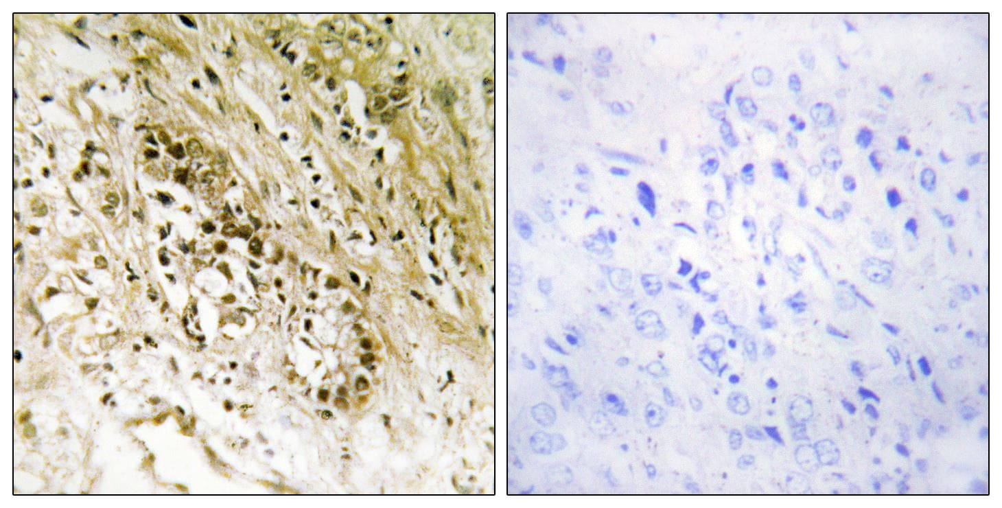 PDZD2 Antibody