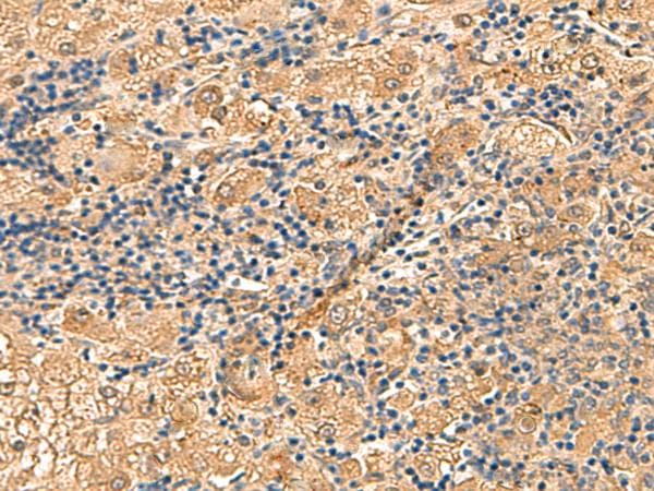 PTHR / PTHR1 Antibody