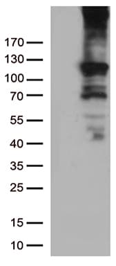 Monoclonal Mouse anti-Human RB1 / Retinoblastoma / RB Antibody (clone OTI11C10, aa309-590, IHC, WB)