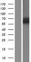 ZNF829 Protein (Over-Expression Lysate Myc-DDK (Flag))
