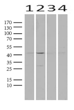 PROCR / EPCR Antibody (aa1-210, clone UMAB200)