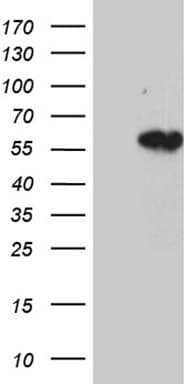 KRT14 / CK14 / Cytokeratin 14 Antibody (aa261-472, clone OTI5F2)