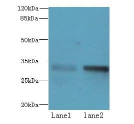 ZHX1 Antibody