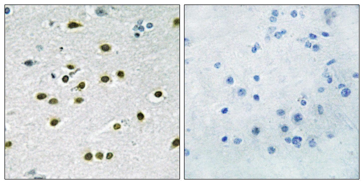 KLF10 + KLF11 Antibody