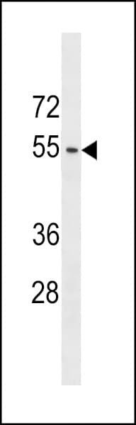 Polyclonal Rabbit anti-Human ACTL9 Antibody (aa23-50, WB)
