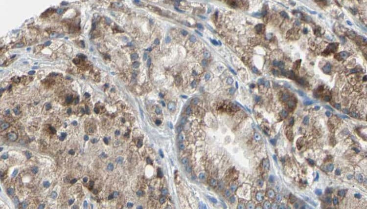Polyclonal Rabbit anti-Human DNAL4 / Dynein Light Chain 4 Antibody (IHC, WB)