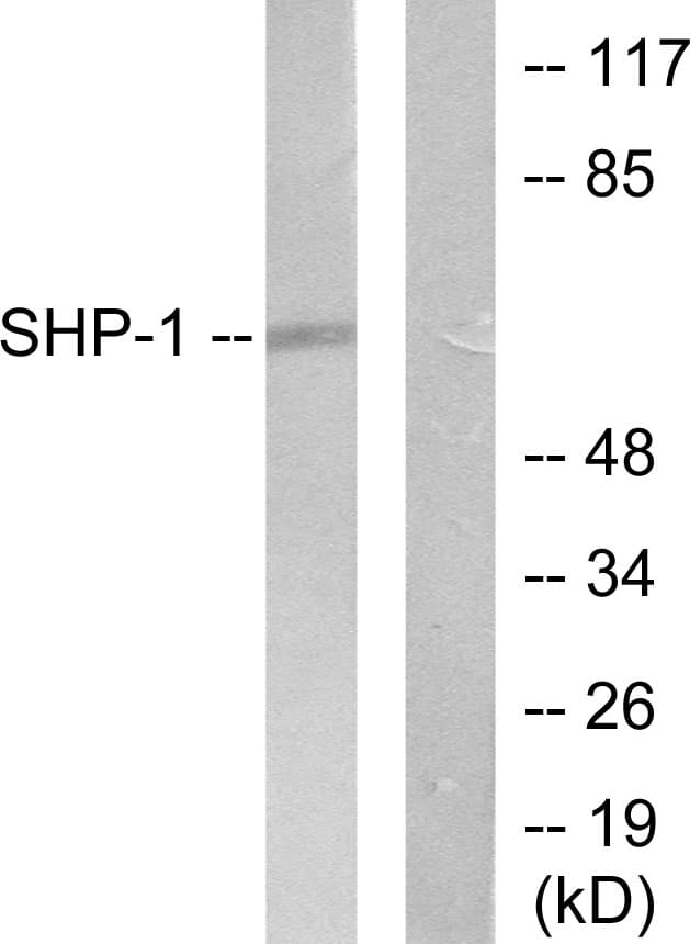Polyclonal Rabbit anti-Human PTPN6 / SHP1 Antibody (aa502-551, IHC, WB)