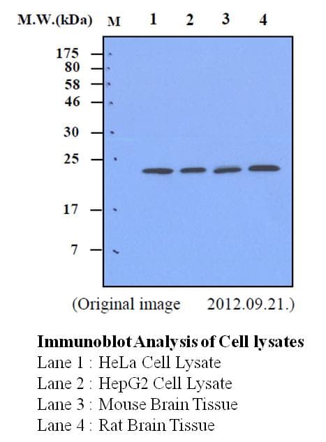 PathPlus™ SOD2 / Mn SOD Antibody