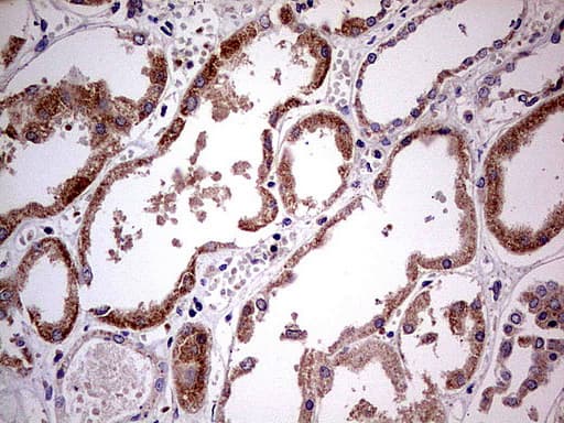 Monoclonal Mouse anti-Human PDSS2 / DLP1 Antibody (clone UMAB177, IHC, WB)