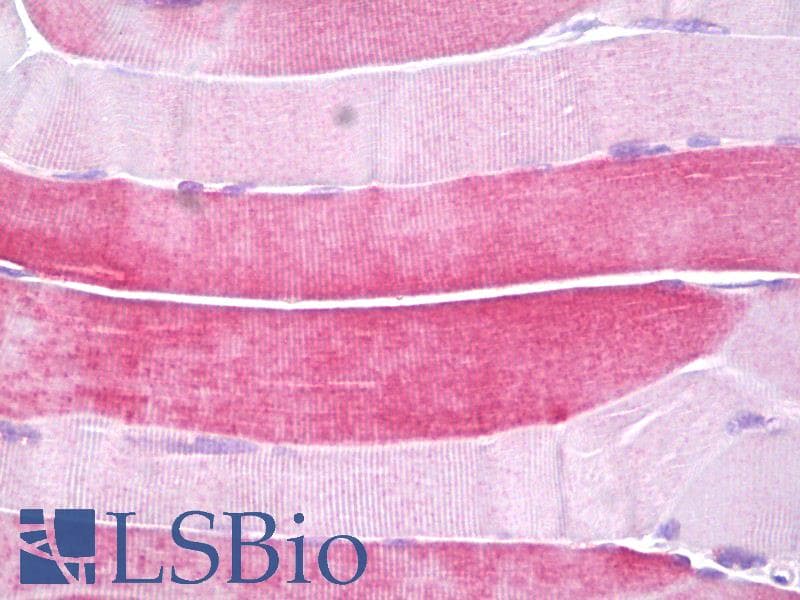 IHC-plus™ Polyclonal Rabbit anti-Human HSPB6 / HSP20 Antibody (aa5-54, IHC)