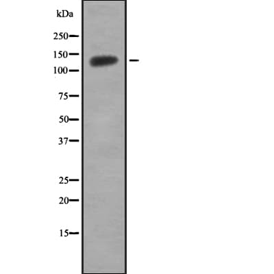HIPK1 Antibody