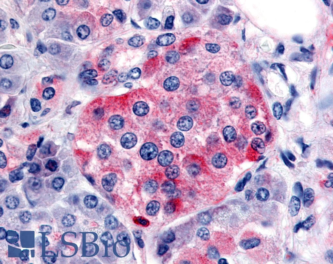IHC-plus™ SSTR1 Antibody (C-Terminus)