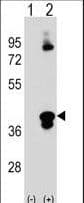 C1QTNF1 / CTRP1 Antibody (aa32-61)