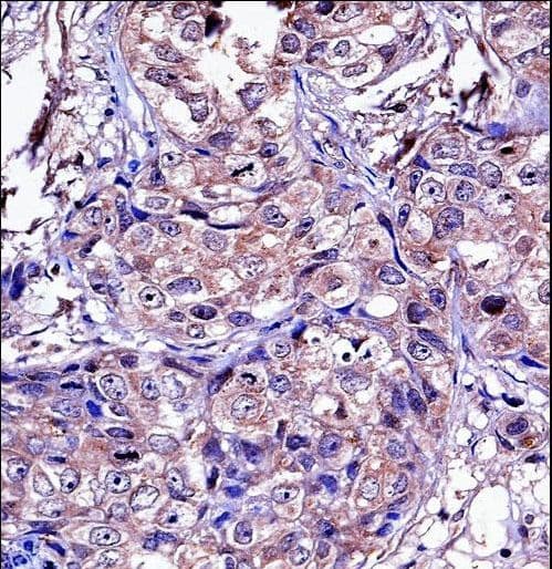 MMP11 Antibody (aa399-428)