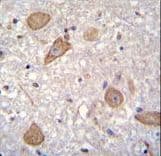 Polyclonal Rabbit anti-Human CNIH2 Antibody (aa31-59, IHC, IF, WB)