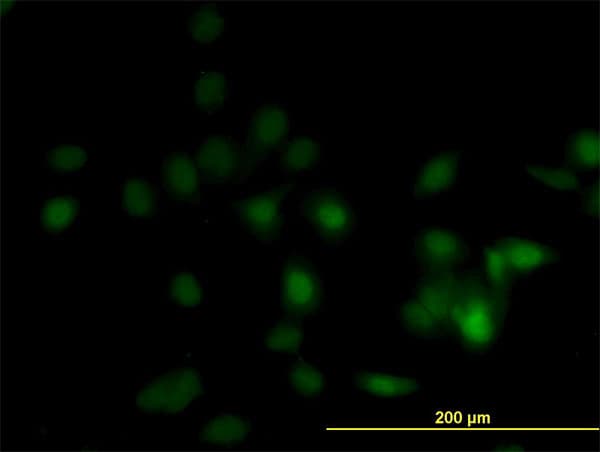 Monoclonal Mouse anti-Human OVCA1 / DPH1 Antibody (clone 2C5, IF, WB)