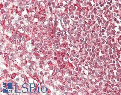 IHC-plus™ APOBEC3C Antibody
