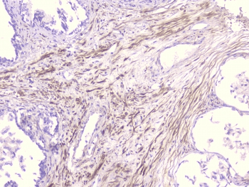 PCDH15 Antibody