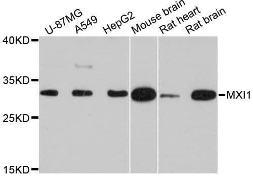 Polyclonal Rabbit anti-Human MXI1 / MAD2 Antibody (WB)
