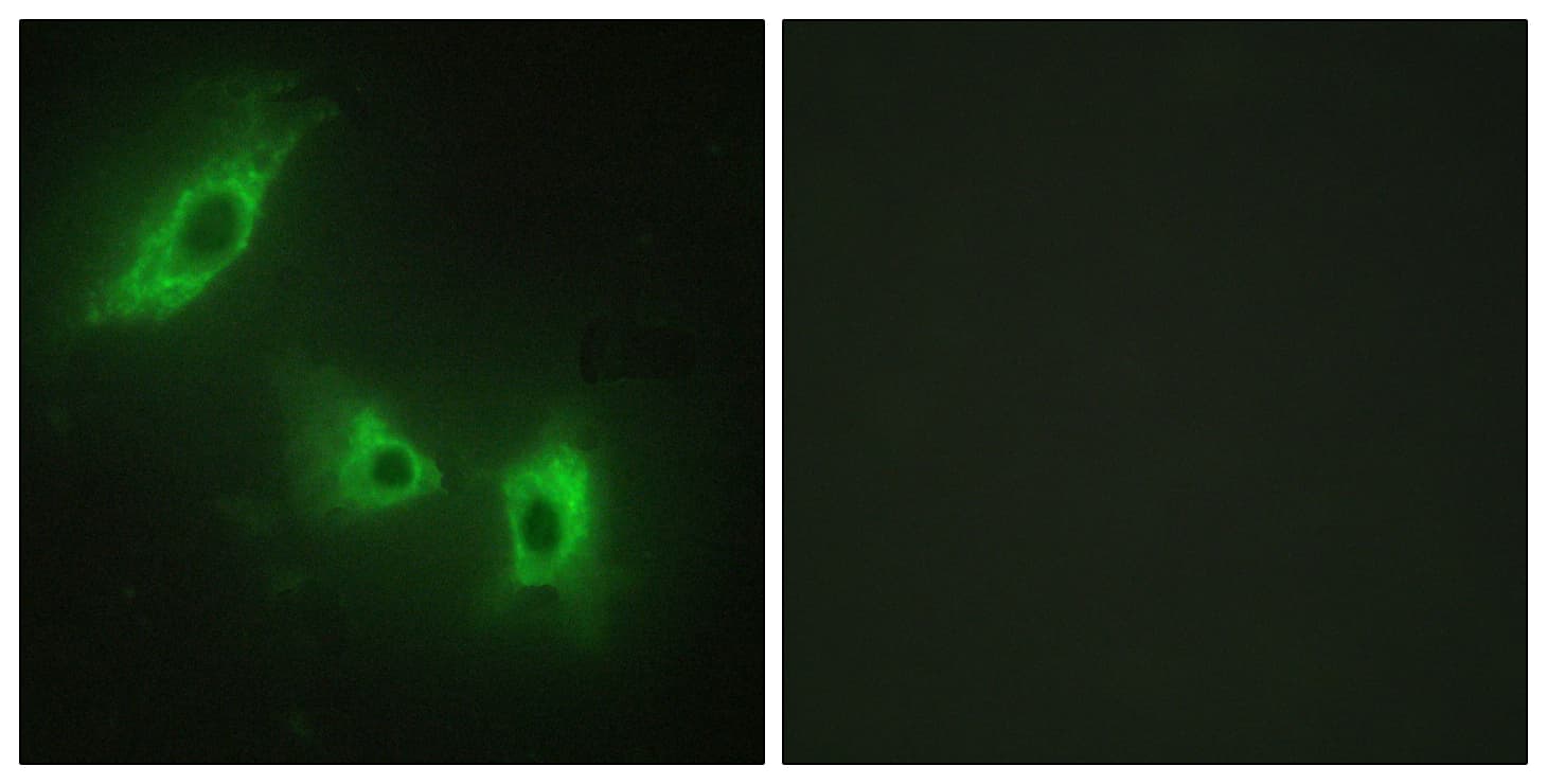ACVR1B / ALK4 Antibody (aa73-122)