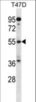 ARFGAP3 Antibody (aa445-473)