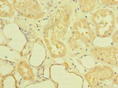 Polyclonal Rabbit anti-Human ST6GALNAC6 Antibody (IHC)