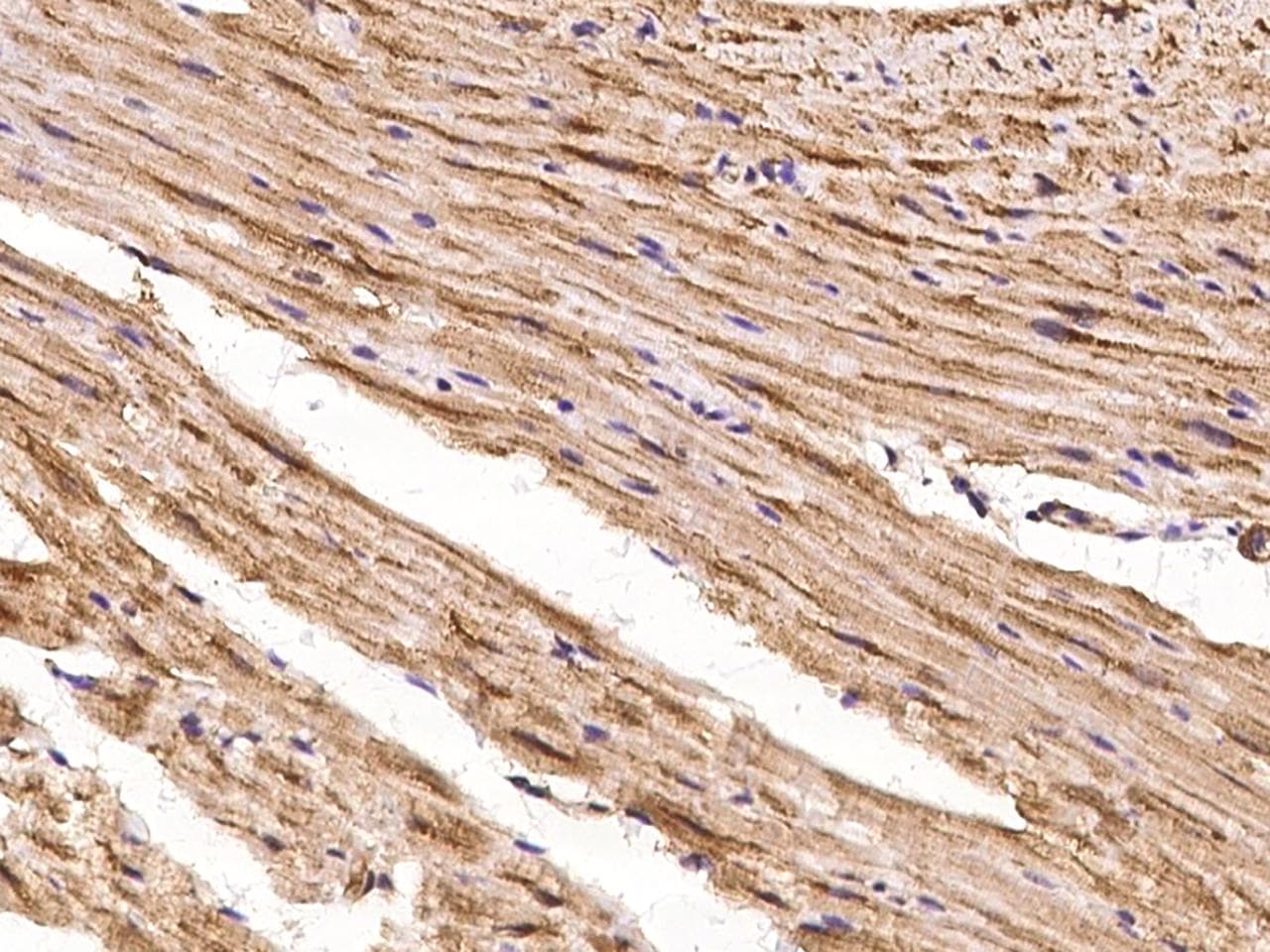 SHD Antibody