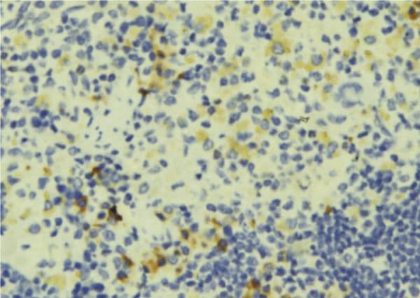 CORO1A / Coronin 1a Antibody