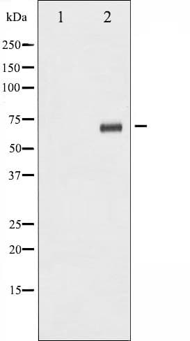 Polyclonal Rabbit anti-Human RPS6KB1 / P70S6K / S6K Antibody (phospho-Ser424, IHC, IF, WB)