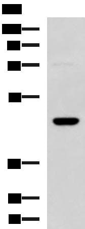 Polyclonal Rabbit anti-Human DNAJA4 Antibody (IHC, WB)