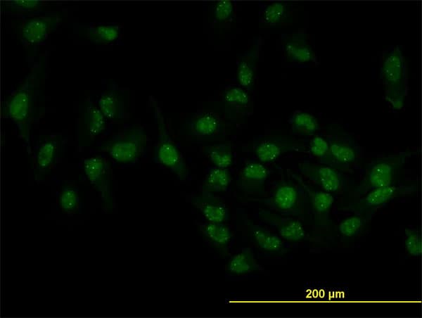 TOE1 Antibody (clone 1C12)