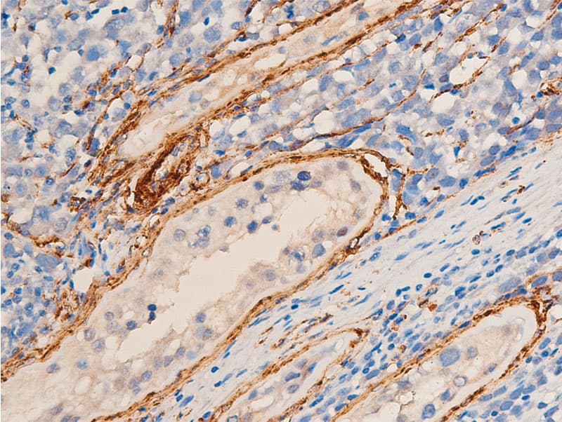 ACTA2 / Smooth Muscle Actin Antibody