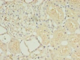 HOXA6 Antibody (Biotin)