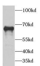 GAD1 / GAD67 Antibody