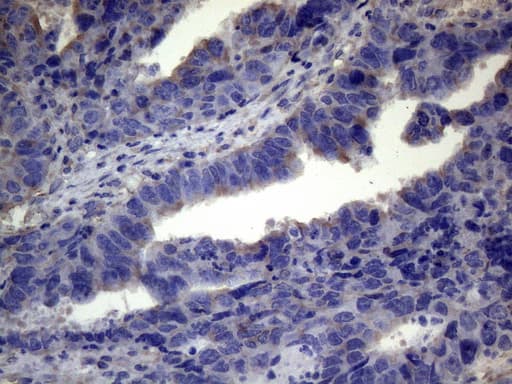 TNFRSF10B / Killer / DR5 Antibody (aa203-411, clone OTI5G5)